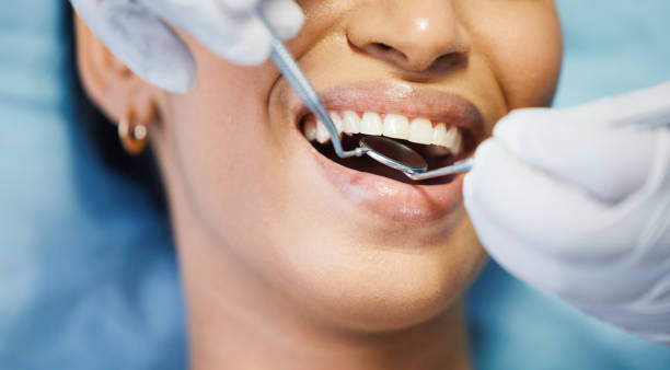 Best Emergency Dental Care for Broken or Chipped Teeth in Leland, NC