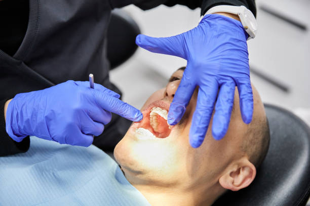 Best Emergency Wisdom Teeth Removal in Leland, NC
